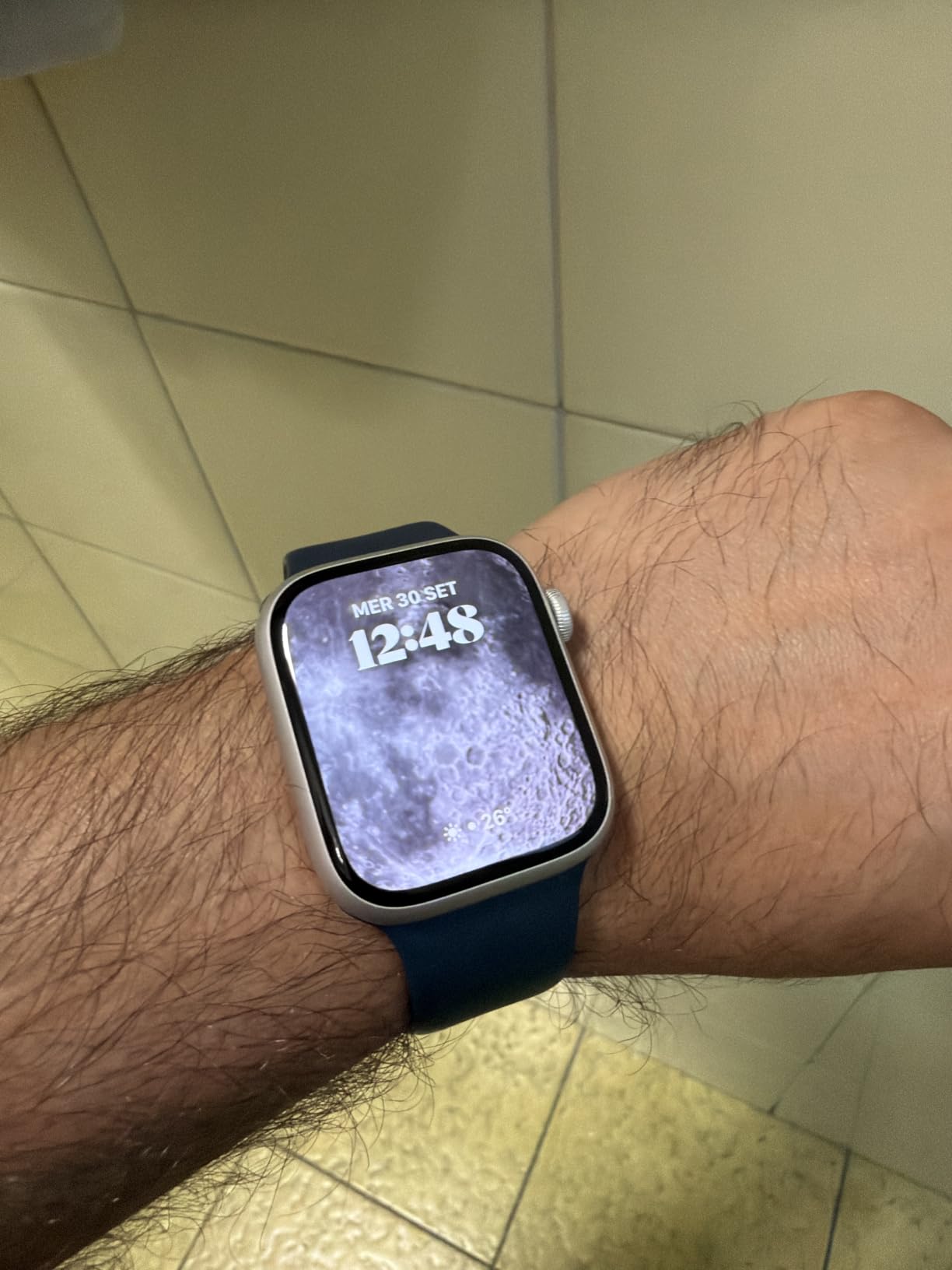 Apple Watch Series 9 GPS 45mm smartwatch rosa display always-on