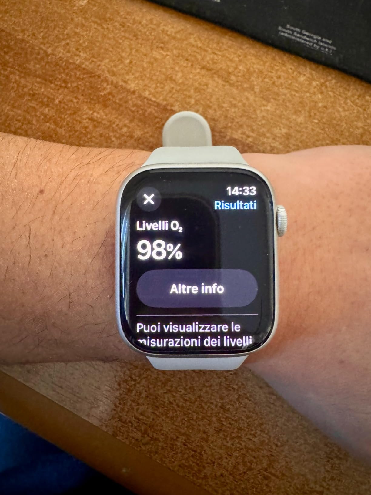 Apple Watch Series 9 GPS 45mm smartwatch rosa display always-on